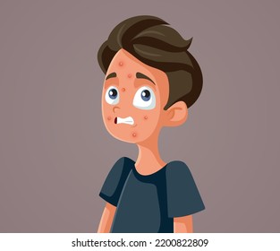 
Stressed Teen Boy Fighting Acne Skin Problem During Puberty. Teenager fighting skin condition during his adolescence years
