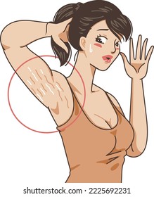stretch marks on the armpit skin