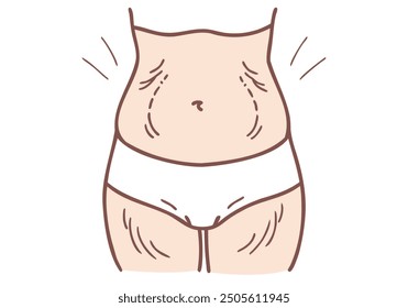 stretch marks on the stomach. Hand drawn style vector design illustrations.