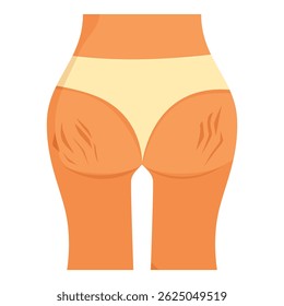 Stretch marks on woman's buttocks and thighs, highlighting cellulite problem, emphasizing body care concept