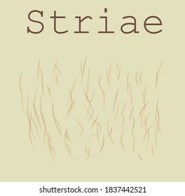 striae. abstract image of stretch marks on the skin. stomach after childbirth. cover of the post about skin defects. imperfections in the body. vector eps 10.
