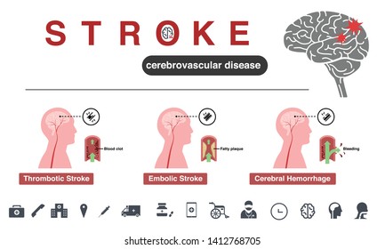 Stroke Cerebrovascular Disease Illustration Icon Set Stock Vector ...