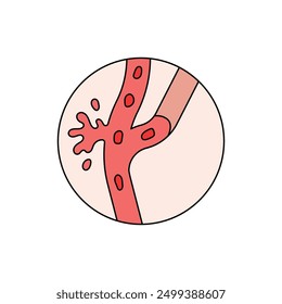 Stroke disease illustration. brain damage. head injury