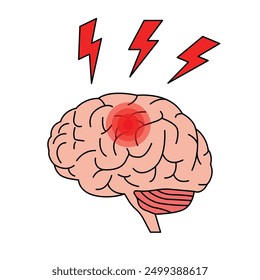 Stroke disease illustration. brain damage. head injury