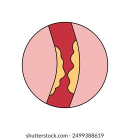 Stroke disease illustration. brain damage. head injury