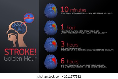 stroke Golden Hour icon design, infographic health, medical infographic. Vector illustration