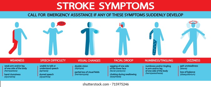 Stroke Symptoms Infographic With Icon Illustrations