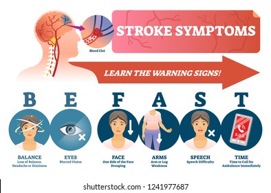 Stroke symptoms vector illustration. Warnings of sudden blood clot in head. Labeled list with reasons for health attention and ASAP ambulance. BE FAST scheme with isolated danger illness risk signs.