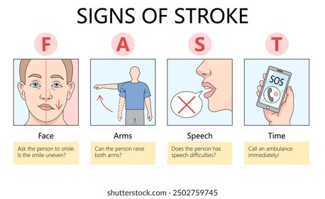 stroke, symptoms, warning, signs, health, infographic, medical, illustration, awareness, dizziness, severe headache, facial droop, speech difficulty, one-sided paralysis, loss of balance, blurry visio