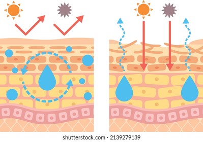 Structural Diagram Skin Skin Broken Barrier Stock Vector (Royalty Free ...