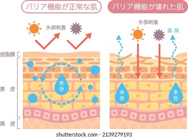 Structural diagram of the skin
Skin with broken barrier function

In Japanese, it is described as "skin with normal barrier function", "skin with broken barrier function", "external stimulus"