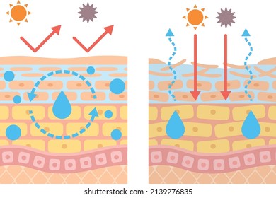 Structural diagram of the skin
Dry skin