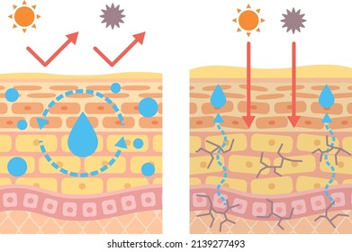 Structural diagram of the skin
Inner dry skin