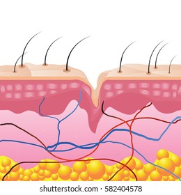 Structural Problems Display Surface Skin Wrinkles Stock Vector (Royalty ...