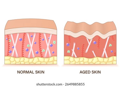 Structure of aged skin. Comparison of normal and aged skin. Facial skin problems. Vector for advertising about beauty and medical treatment.