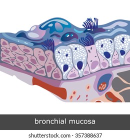 Structure of damaged bronchial mucosa with sputum, vector illustration