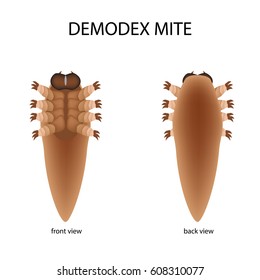 The structure of the demodex mite. Front view and rear view. Demodecosis. Infographics. Vector illustration on isolated background.