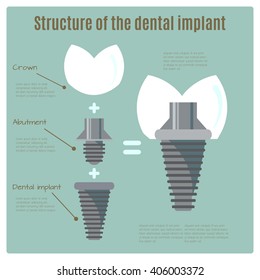 Structure of the dental implant. Infographic about dentistry. All objects are conveniently grouped  and are easily editable.