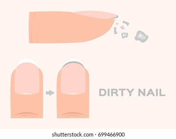 Structure of a dirty Finger Nail . human . anatomy