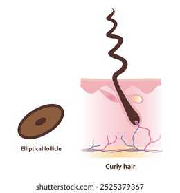 Estrutura de folículo em forma elíptica e ilustração de vetor de cabelo encaracolado em fundo branco. A seção transversal do folículo elíptico produz cabelos crespos e frios com camada de couro cabeludo. Conceito de anatomia do cabelo.