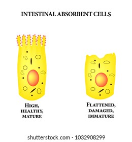 Structure of the enterocyte. Deformed, sick cell. absorptive cells intestine. Infographics. Vector illustration on isolated background.
