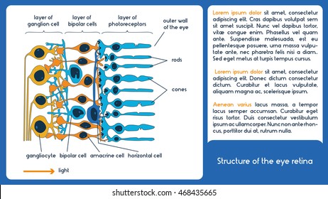 Structure Eye Retina Infographic Scheme Stock Vector (Royalty Free ...