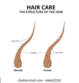 The Structure Of The Hair, The Cuticle Of A Healthy And Damaged Human Hair.