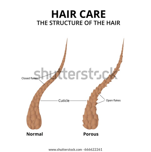 Human Hair Has Which Type Of Cuticle on Sale, 53% OFF |  
