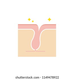 Structure illustration of pores / Clean pore