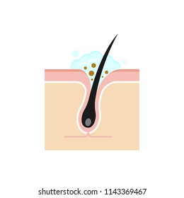 Structure illustration of pores /cleansing, clear whiteheads.