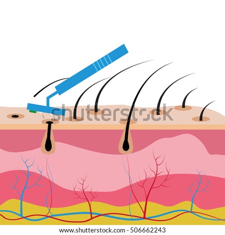 structure skin hair removal by shaving stock vector (royalty free
