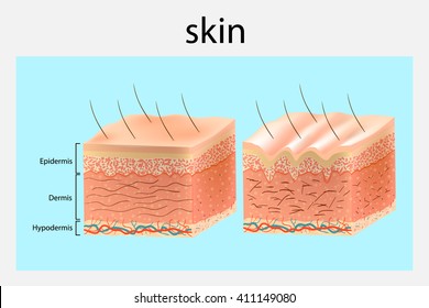 The Structure Of The Skin. Younger Skin And Aging Skin. Vector Diagram