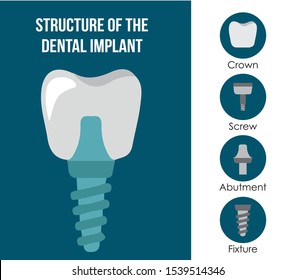 Structure of the tooth implant vector illustration flat design