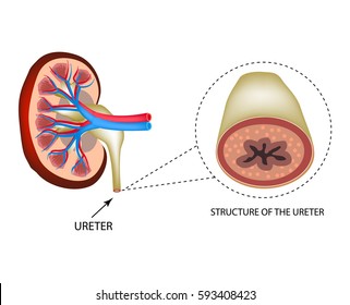 URETERAL