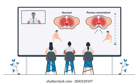 Students study about Pectus excavatum that is a structural deformity of anterior thoracic wall. Pulmonology vector illustration about restrictive lung disease.