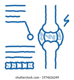 study of bone arthritis sketch icon vector. Hand drawn blue doodle line art study of bone arthritis sign. isolated symbol illustration