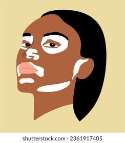 Stylish vitiligo woman portrait vector illustration in modern style.Beauty skin.World vitiligo day June 25.Beautiful face of an African American woman.Diversity tolerance concept.