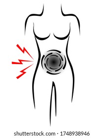 Stylized female body with pain point in the belly