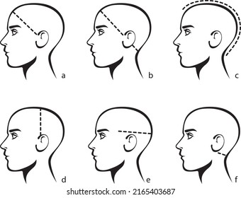 Image stylisée d'une tête de mâle. Modèle de sélection de la taille d'un système de poils ou de perruques pour les hommes. Graphique de taille de mesure. Illustration vectorielle isolée sur fond blanc.