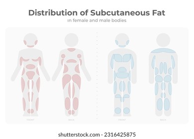 Subcutaneous fat distribution in men and women pictogram.
Vector infographic medical of fat mass areas in male and female body.
Target areas for diet treatment, liposuction, fat freezing liposculpture