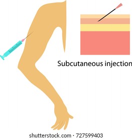 Subcutaneous Injection Images, Stock Photos & Vectors | Shutterstock