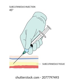 Subcutaneous injection. Effective methods of administration of drugs and other medical solutions that are used for humans and animals. Vector illustration isolated on white background.