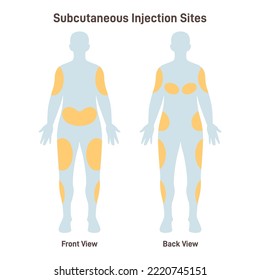 Subcutaneous injection sites. Medicine injection sites on the human body. Upper outer arms, abdomen, buttocks, upper outer thighs. Flat vector illustration