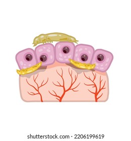 Subcutaneous tick. Skin parasite. Beetles on human epidermis. Harmful insects are carriers of disease demodecosis. Flat cartoon illustration