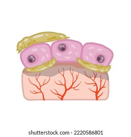 Subcutaneous tick. Skin parasite. Beetles on human epidermis. Harmful insects are carriers of disease demodecosis. Flat cartoon illustration