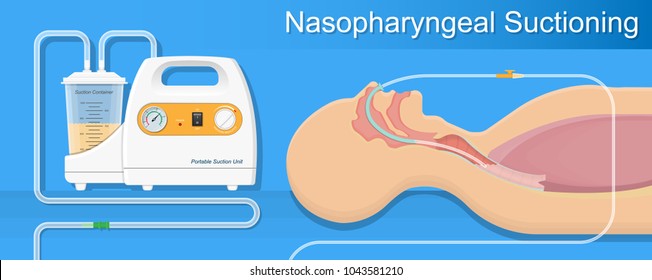 Anesthesia Oxygen Inhalator Poster Print Anesthesiology Nurse Gift Hospital
