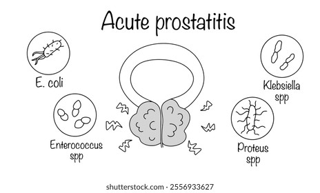 Sudden inflammation of the prostate caused by a bacterial infection. Hand-drawn acute prostatitis and bacteria that cause the disease. Black and white vector for different uses. Acute prostatitis. 