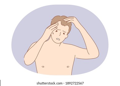 Suffering from pain in muscles, joints, losing hair concept. Young unhappy frustrated man cartoon character standing and touching head, feeling headache or suffering from losing hair