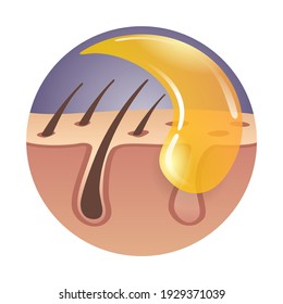 Sugaring - Persian sugar waxing, hair removal method using hot wax. Vector illustration