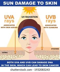 Sun damage to skin.The difference of radiation 2 types in sunlight which is harmful to the skin. Infographic of difference between UVA and UVB rays. UV penetration into human skin and woman face.